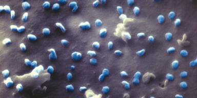 Sensation: Aufnahmen zeigen Coronavirus an der Zelle