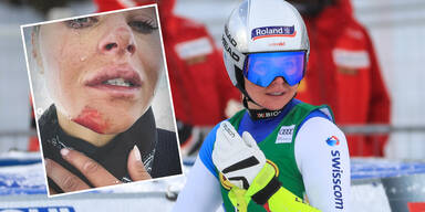 Blut & Tränen: Ski-Beauty mit emotionalem Posting