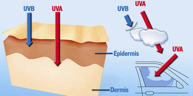 Wie UV-Strahlen zu Hautschäden führen