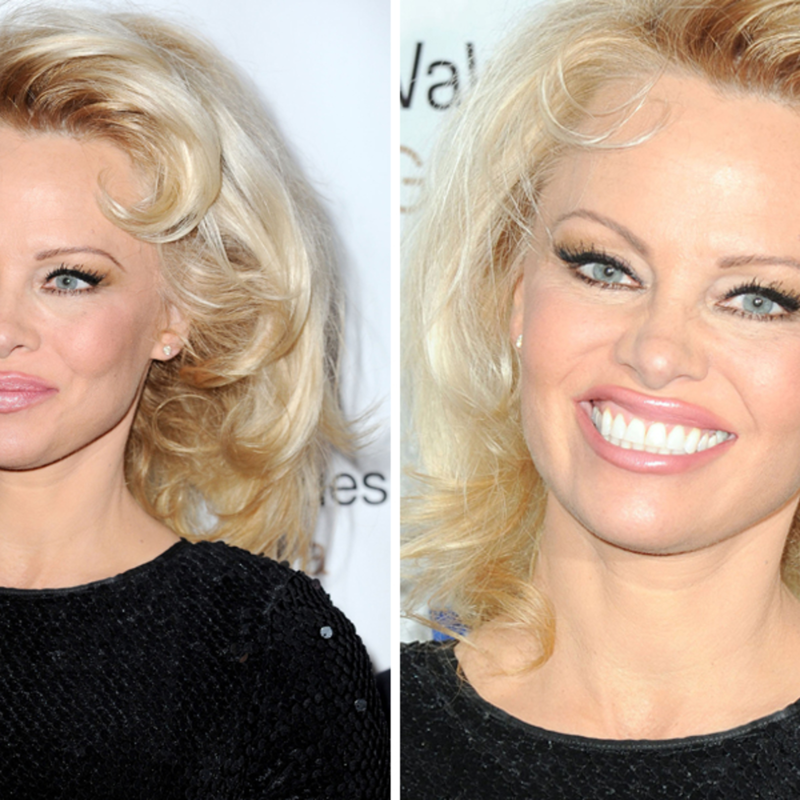 Pamela Anderson vorher und nachher