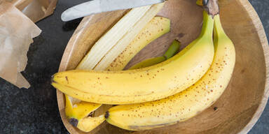 Bananenschale: 6 überraschende Beauty-Tipps