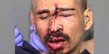 Polizeifoto zeigt Mann mit Kopfschuss