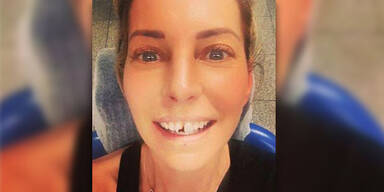Giulia Siegel: Zahn ausgeschlagenen