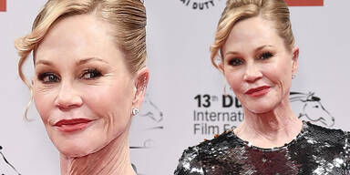 Melanie Griffith: Total verbotoxt
