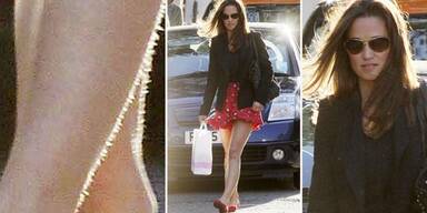 Pippa Middleton mit unrasierten Beinen