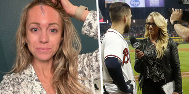 Mega-Narbe: TV-Reporterin von Baseball getroffen