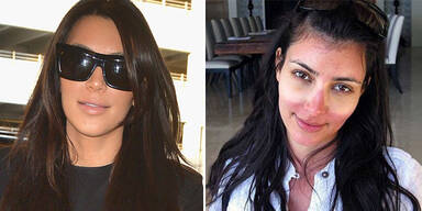 Kardashian: In der Sonne eingeschlafen