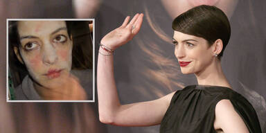Anne Hathaways schreckliches Film-Makeover