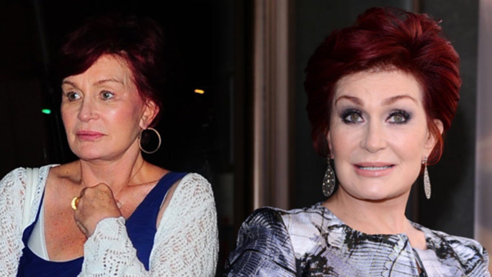 Sharon Osbourne zeigt ihr neues Botox-Gesicht - madonna24.at