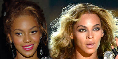 Hat Beyoncé ihre Nase verschmälern lassen?