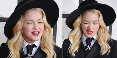 Madonna schockt mit Botox-Fratze