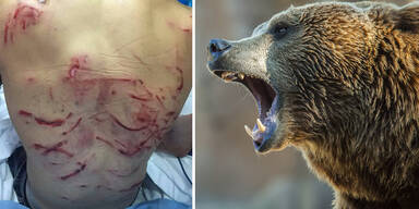 Junger Polizist: 'Bär hat meinen Rücken zerfleischt"