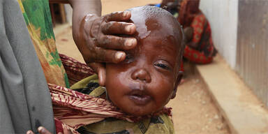 Hungersnot Afrika