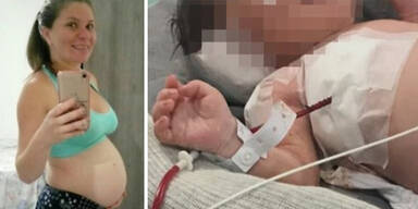 Schwangerer in Bauch geschossen: Baby überlebt