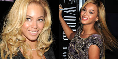 Hat sich Beyoncé die Haut bleichen lassen?