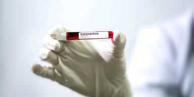 Blutgruppe beeinflusst Schwere von Corona-Verlauf