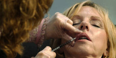 England verbietet Botox für Minderjährige