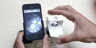 "CellScope" macht Handy zum Mikroskop