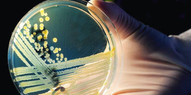 Forscher identifizieren Bakterium