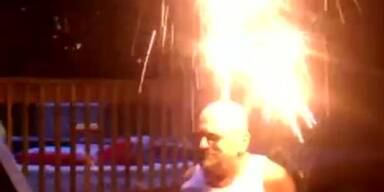 Mann entzündet Feuerwerk auf seinem Kopf