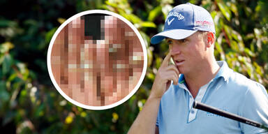 Golf-Profi schockt mit Grusel-Foto