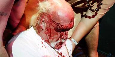 Hulk Hogan blutig geschlagen