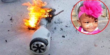 Explodiertes Hoverboard tötet 3-Jährige