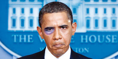 Barack Obama mit blauem Auge (Montage)