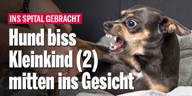 Hund biss Kleinkind (2) mitten ins Gesicht