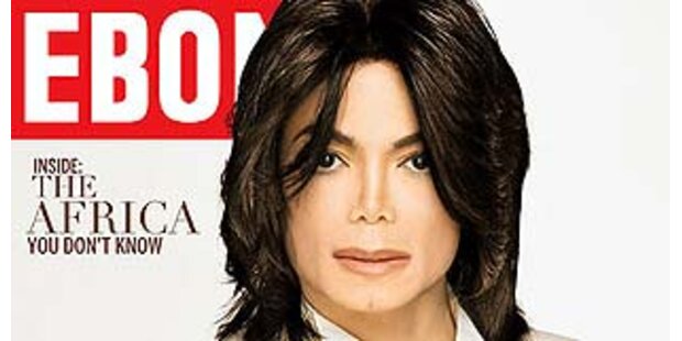 Michael Jackson hat weiße Hautfarbe
