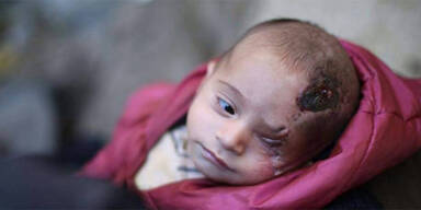 Baby Karim wird zum Symbol des Krieges