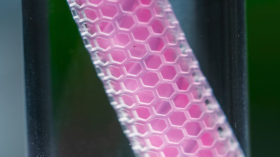 Krebs-Heilung in 60 Tagen: Implantat macht Patienten Hoffnung