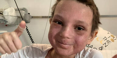 Krebsdrama: Instagram-Star Lana Sanders mit 12 Jahren gestorben