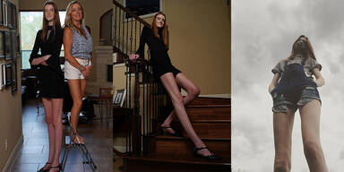 Diese Teenagerin hat die längsten Beine der Welt