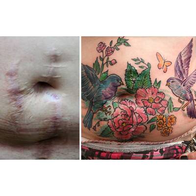 Tattookünstlerin verdeckt Narben von Gewaltopfern