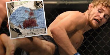MMA-Fighter mit Horror-Unfall im Intim-Bereich