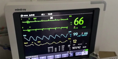 Monitor im Krankenhaus