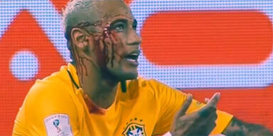 Neymar blutüberströmt vom Platz getragen