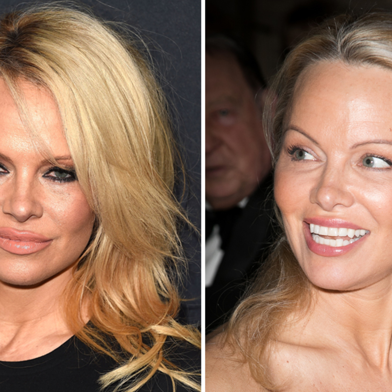 Pamela Anderson vorher und nachher