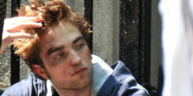 Robert Pattinson wurde verprügelt!
