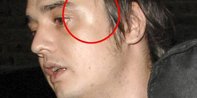 pete_doherty_auge_pps