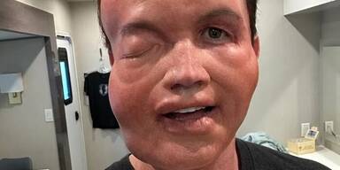 Allergischer Schock? Schauspieler postet Horror-Foto
