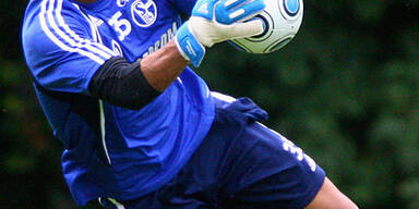 Schalke-Goalie ins Aug gestochen