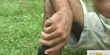 Kubaner hat 12 Finger und 12 Zehen