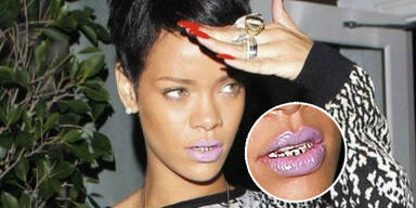 Rihanna  zeigt sich mit  Gold-Gebiss