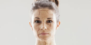 Was hilft bei trockener Haut?