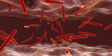 Der Kampf gegen Tuberkulose ist noch lange nicht gewonnen