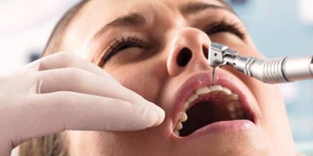 Wurzelbehandlungen auf den Zahn gefühlt
