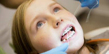 Gratis-Zahnspange nur für ganz wenige Kinder