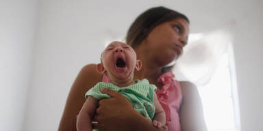 Zika-Virus in Babygehirnen entdeckt